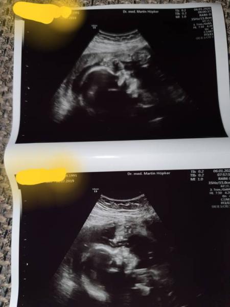 Bild zu Zurück vom Doc - Forum für April - Mamis