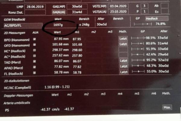 Bild zu Heute FA-Termin 💖 - Forum für April - Mamis