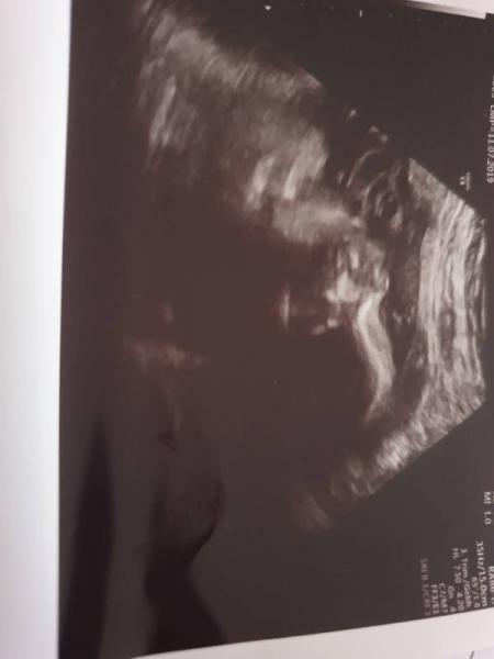 Bild zu Zurück vom Frauenarzt - Forum für April - Mamis