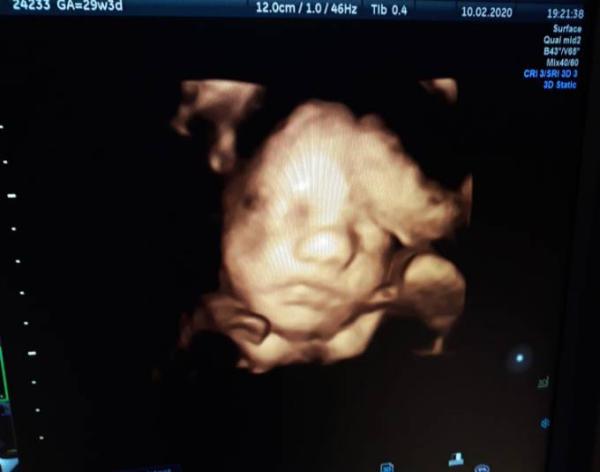 Bild zu Zurück vom Fa ♡ - Forum für April - Mamis