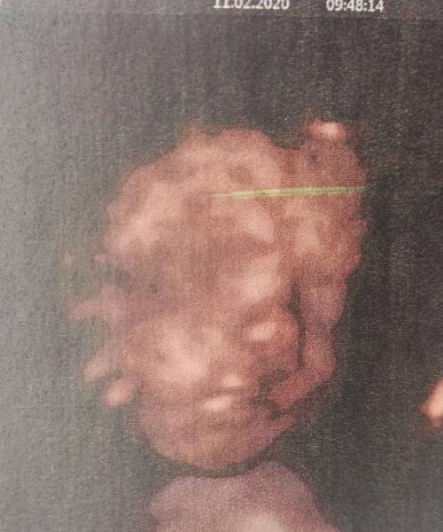 Bild zu Zurück von FA, Freude, Sorge, Verärgerung - Forum für April - Mamis