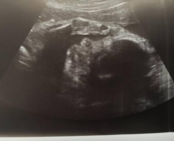 Bild zu Jammern die hormone und ich - Forum für April - Mamis