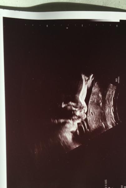 Bild zu Frauenarzttermin - Forum für April - Mamis