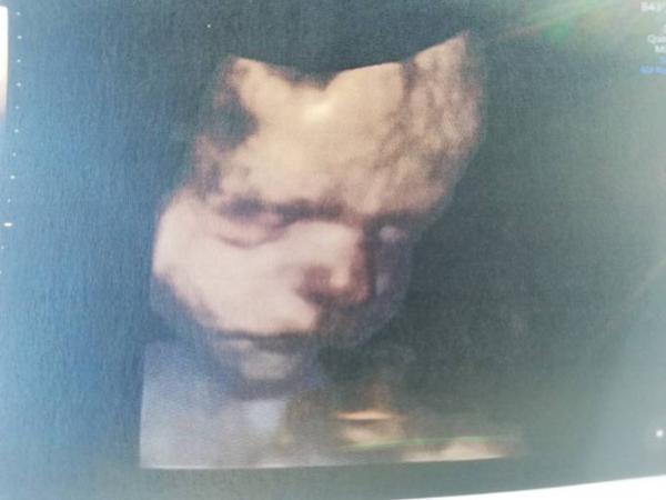 Bild zu Kindslage - Forum für April - Mamis