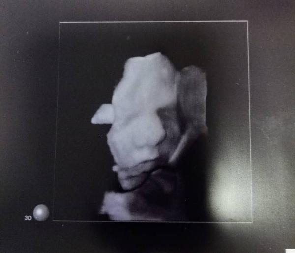 Bild zu Der Sectio Termin steht - Forum für April - Mamis