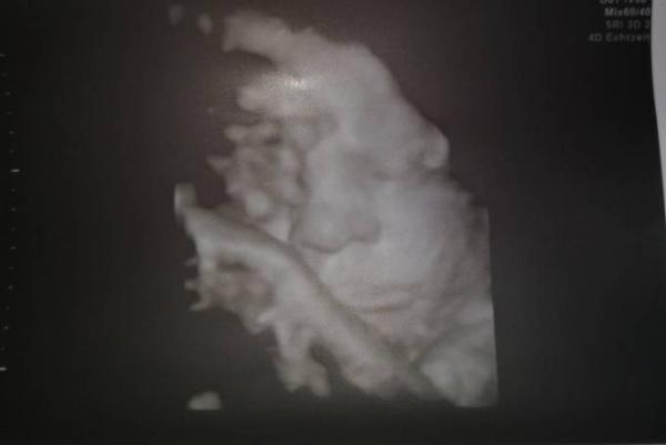 Bild zu Zurück vom FA - Forum für April - Mamis