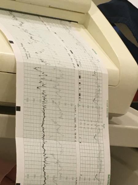 Bild zu Veräppelt vom Körper - Forum für April - Mamis