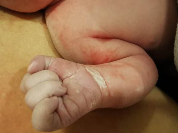 Bild zu Ausgekugelt - Forum für April - Mamis