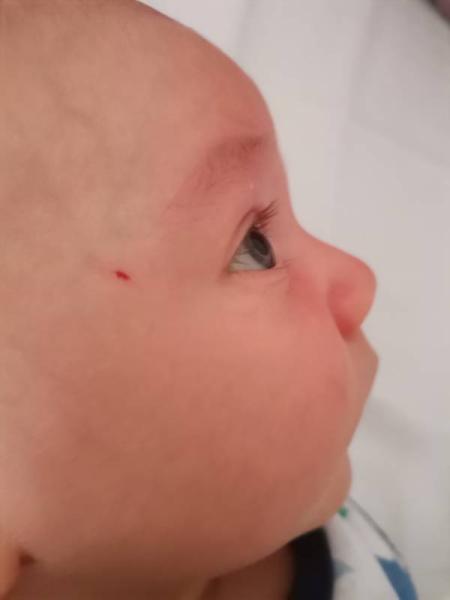 Bild zu Er kratzt sich :( - Forum für April - Mamis
