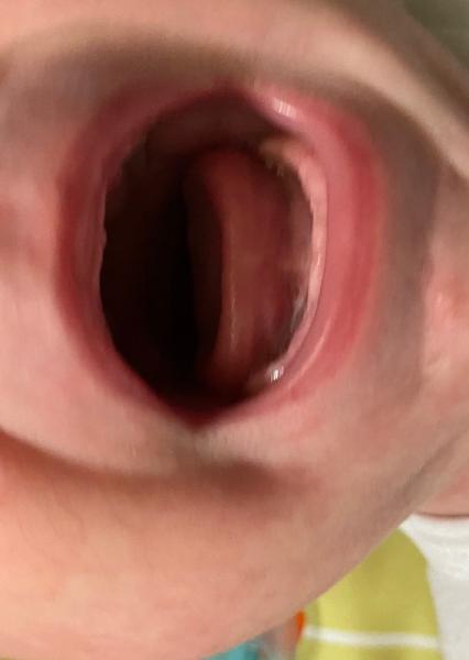 Bild zu Zahnt er schon? - Forum für April - Mamis