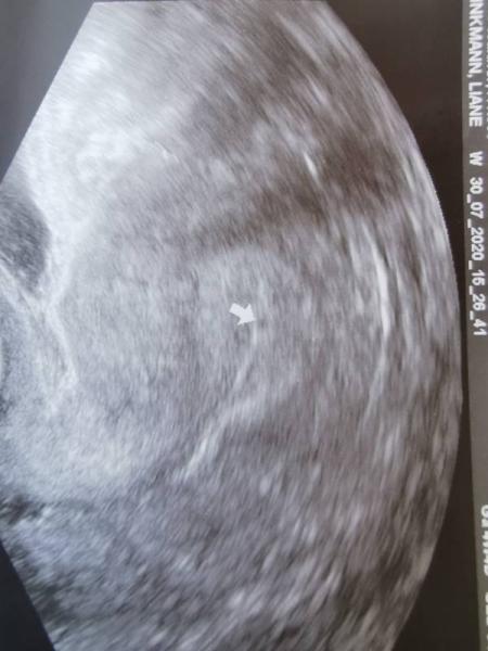 Bild zu FA - Forum für April - Mamis