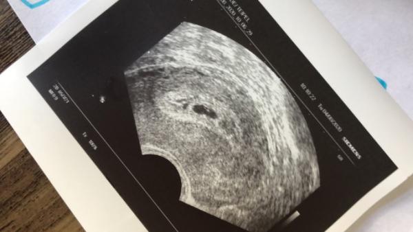 Bild zu Hallöle - Forum für April - Mamis