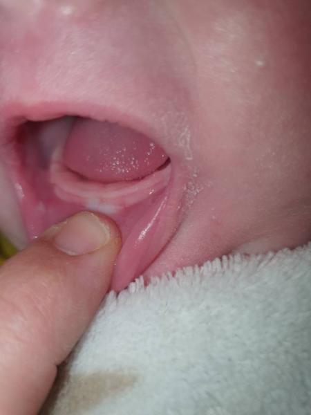 Bild zu Sowas von fertig mit den Nerven:( - Forum für April - Mamis