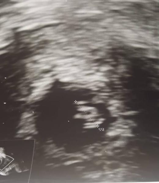 Bild zu Hallo alle miteinander! - Forum für April - Mamis