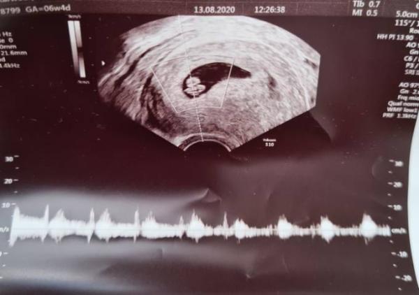 Bild zu Das Herz ❤ schlägt - Forum für April - Mamis