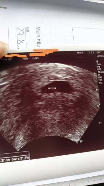Bild zu Wir dürfen auch mit fahren ☺️ - Forum für April - Mamis