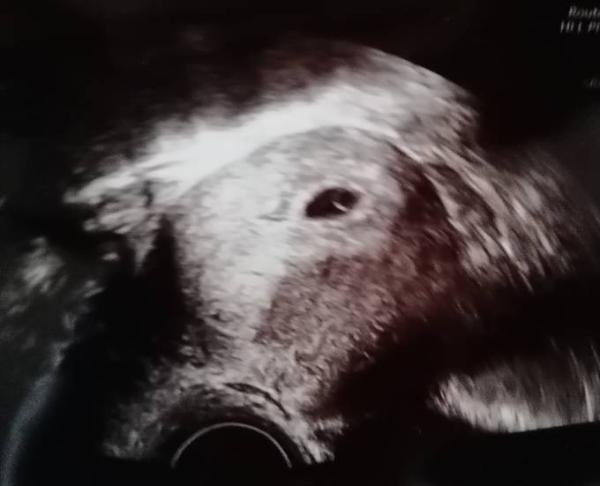Bild zu Nach verschobenem Eisprung auch dabei - Forum für April - Mamis
