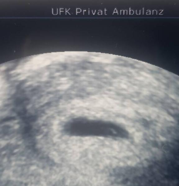 Bild zu 1. US Termin - Forum für April - Mamis