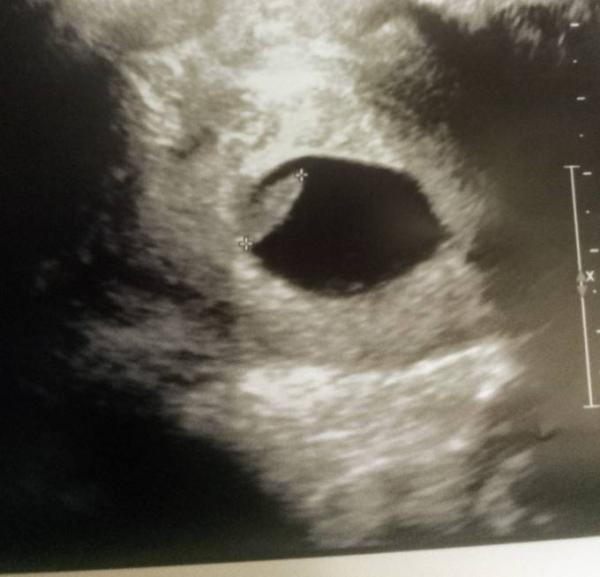 Bild zu Endlich offiziell schwanger ❤️ heute erster Termin ❤️ - Forum für April - Mamis