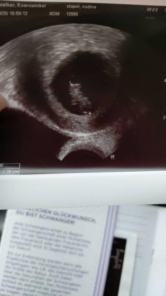Bild zu Auch zurück vom FA - Forum für April - Mamis