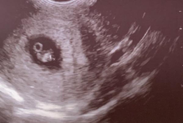 Bild zu Huhuuu auch zurück vom FA - Forum für April - Mamis