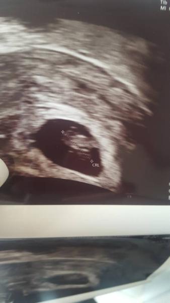 Bild zu Zurück vom Us - Forum für April - Mamis