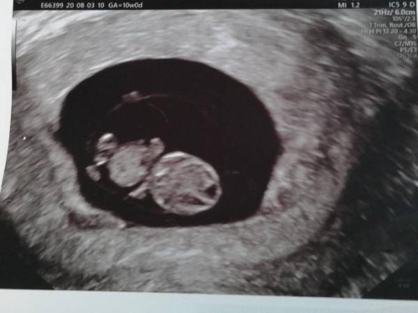Bild zu Zurück vom FA - Forum für April - Mamis