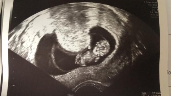 Bild zu Zurück 😍 - Forum für April - Mamis