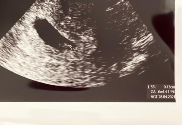Bild zu 1. FA-Termin ✅ - Forum für April - Mamis