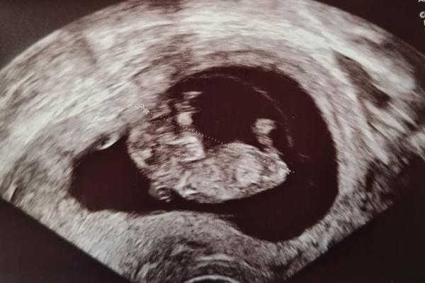 Bild zu Gestern Termin beim Gyn - Forum für April - Mamis