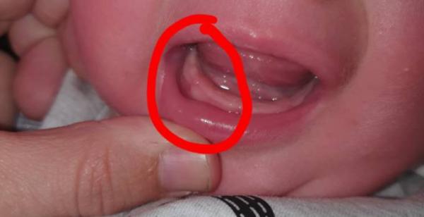 Bild zu Zähne? - Forum für April - Mamis