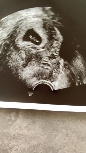 Bild zu Zurück vom FA, was für ein auf und ab 🙈 - Forum für April - Mamis