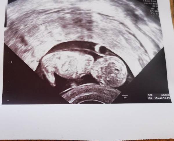 Bild zu Zappelphillip - Forum für April - Mamis
