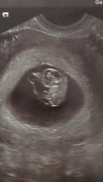 Bild zu FA- Termin - Forum für April - Mamis