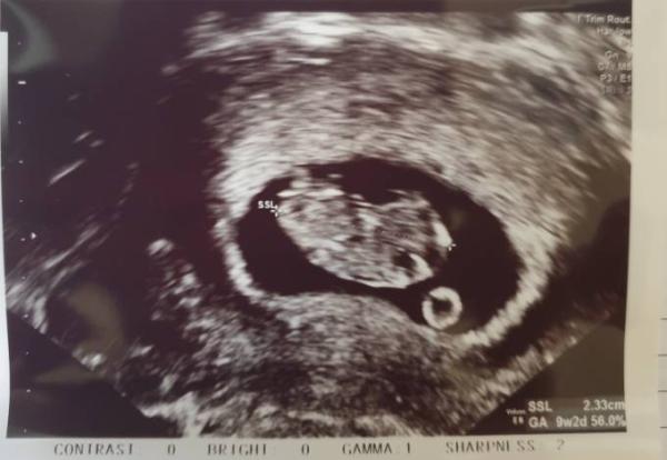 Bild zu Zurück vom FA Termin - Forum für April - Mamis