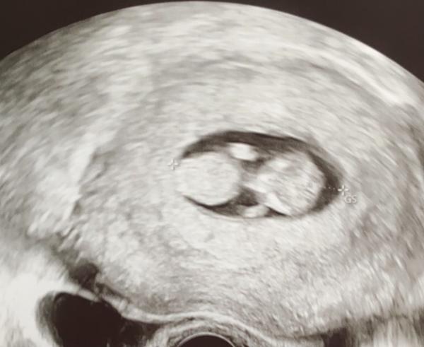 Bild zu Zurück vom FA - Forum für April - Mamis