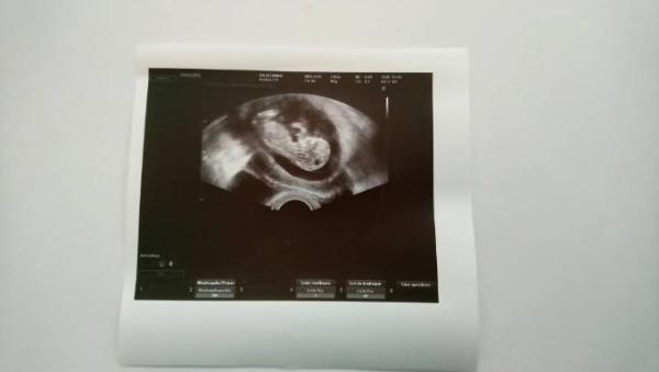 Bild zu Hallo erstmal :) - Forum für April - Mamis