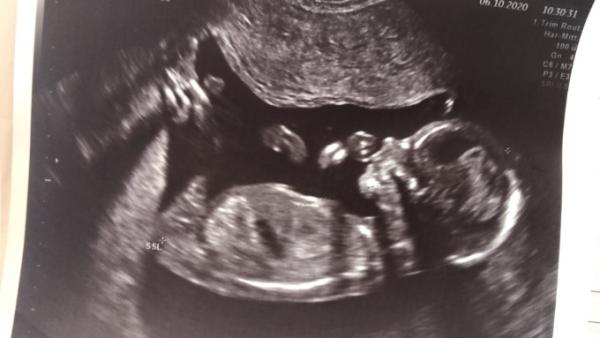 Bild zu Zurück von FA - Forum für April - Mamis