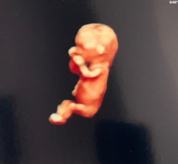 Bild zu Ersttrimmesterscreening +tolles Bild 😍 +Geschlecht - Forum für April - Mamis