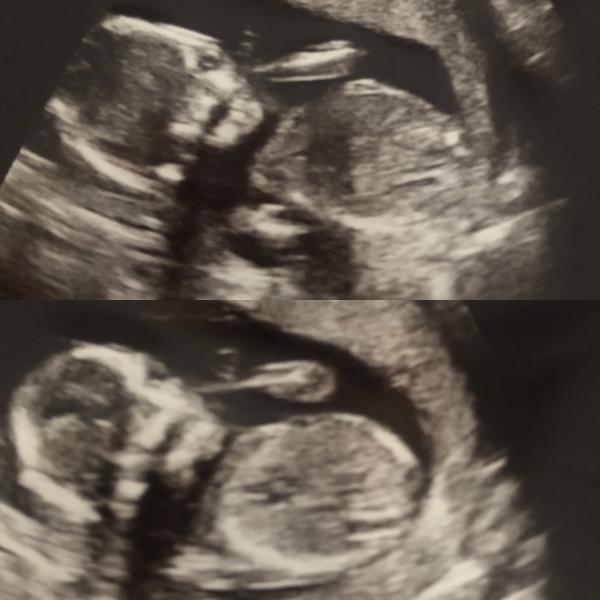 Bild zu Geschlecht 🤔 - Forum für April - Mamis