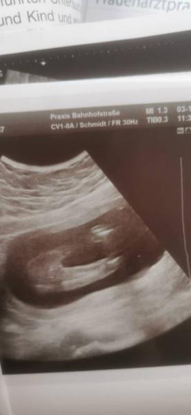 Bild zu 18 ssw outing... - Forum für April - Mamis
