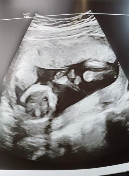 Bild zu Zurück vom FA - Forum für April - Mamis