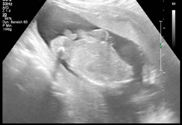 Bild zu Heute auch Termin gehabt ❤️ - Forum für April - Mamis