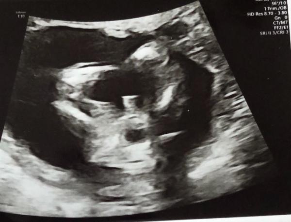 Bild zu Geschlecht - Forum für April - Mamis