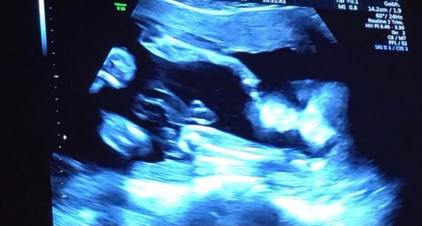 Bild zu Babybewegungen - Forum für April - Mamis