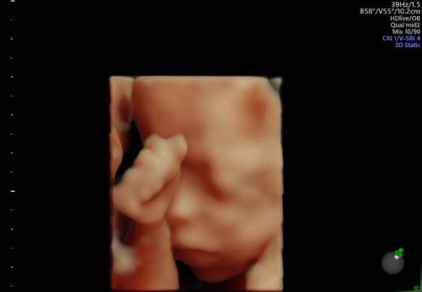 Bild zu Organscreening - Forum für April - Mamis