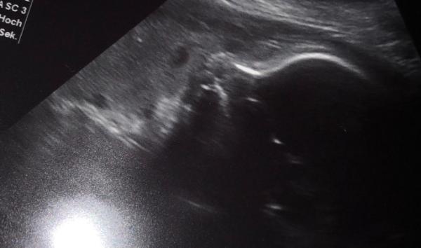Bild zu 33+0 Frauenarzt Termin - Forum für April - Mamis