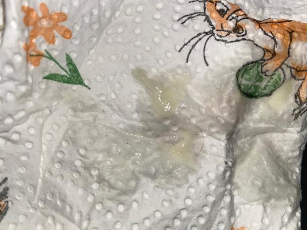 Bild zu Schleimpfropf? - Forum für April - Mamis