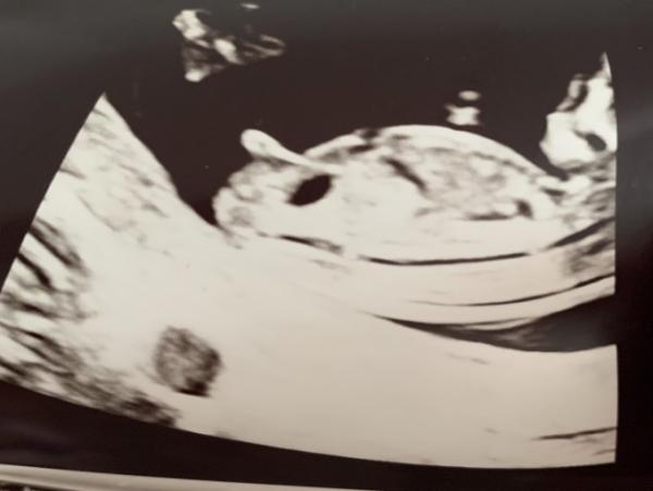 Bild zu Nub Theorie - Forum für April - Mamis