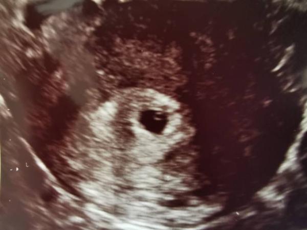 Bild zu 5+4 ultraschall - Forum für April - Mamis